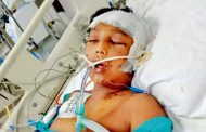 বৈষম্যবিরোধী ছাত্র আন্দোলন : ৪১ দিন ধরে আইসিইউতে জীবন-মৃত্যুর সন্ধিক্ষণে বগুড়ার ছোট্ট রাতুল