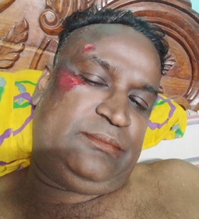 বোচাগঞ্জ দিনাজপুর সড়ক যেন মৃত্যুর ফাঁদ