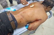 গোবিন্দগঞ্জে দোকানে সিগারেট না পাওয়ার জেরে এলোপাথরি ছুরিকাঘাতে বিএনপি ও জামায়াতের ৬ নেতাকর্মী আহত