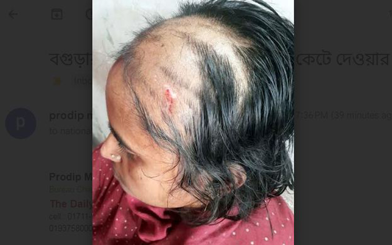 বগুড়ার পরকীয়ার জেরে গৃহবধূর চুল কেটে দেওয়ার অভিযোগ