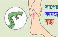 কুষ্টিয়ায় সাপের কামড়ে নারীর মৃত্যু