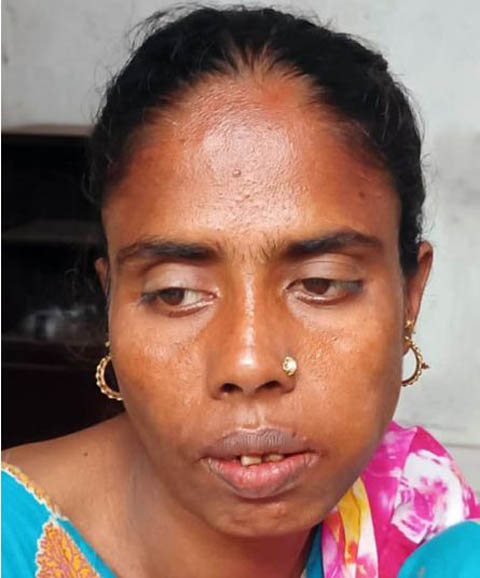 ধুনটে পুলিশের ওপর হামলা, হাতকড়া পরা আসামি ছিনতাই গ্রেপ্তার হলেন আসামির মা