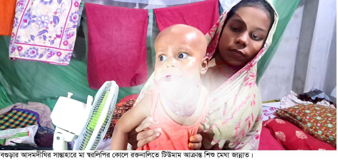 সান্তাহারে রক্তনালিতে টিউমার আক্রান্ত ৯মাস বয়সী শিশুকে বাঁচাতে বাবা-মায়ের আকুতি