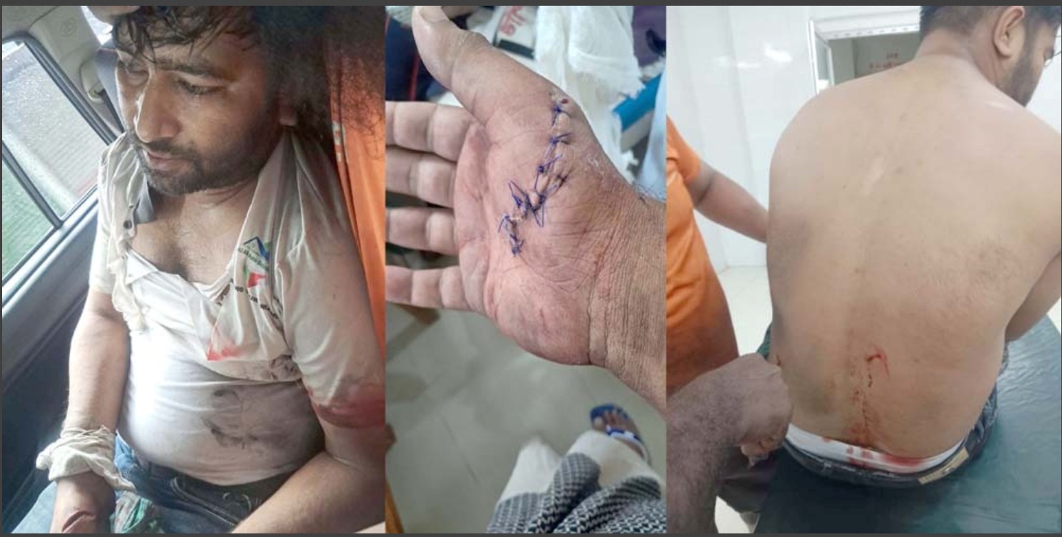 বোয়ালমারীতে মাটি চোরদের হামলায় ইটভাটা ম্যানেজার মারাত্মক আহত