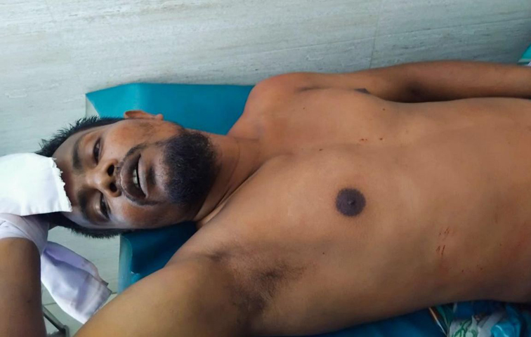 দ্বিতীয় বিয়ে করায় স্বামীর পুরুষাঙ্গ কাটল স্ত্রী