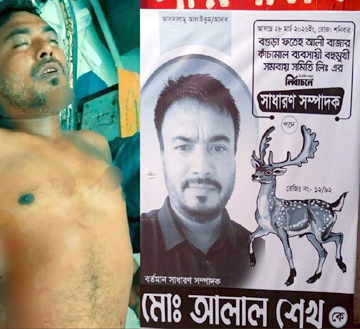বগুড়ায় ভোটের দিন বাজার সমিতির সম্পাদক প্রার্থীকে তুলে নিয়ে হাত-পা ভাঙল দুর্বৃত্তরা