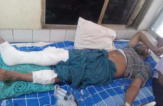 বোয়ালমারীতে ব্যবসায়ীকে কুপিয়ে টাকা ছিনতাই