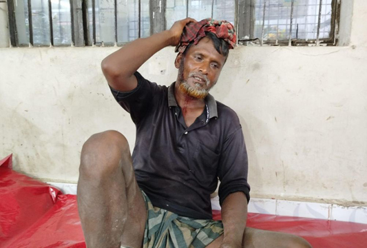 কিশোরী মেয়েকে উত্যক্ত করার ক্ষোভে ৪ জনের মাথা ফাটালেন বাবা 