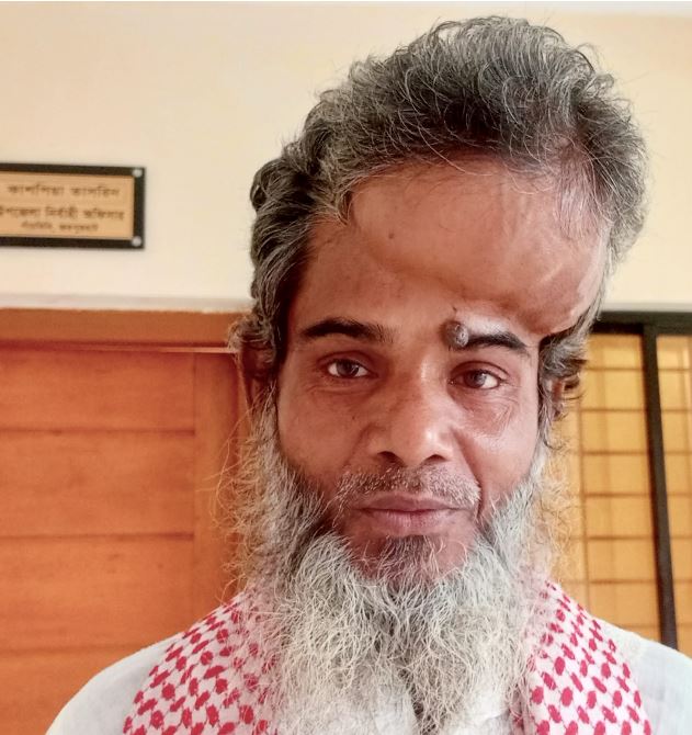 টাকার অভাবে চিকিৎসা থেমে আছে মাথায় টিউমা আক্রান্ত জয়নাল