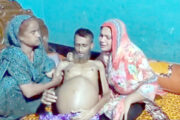 জীবন বাঁচাতে লড়ছেন ইমরান, চিকিৎসার খরচ জোগাতে অসহায় পরিবার