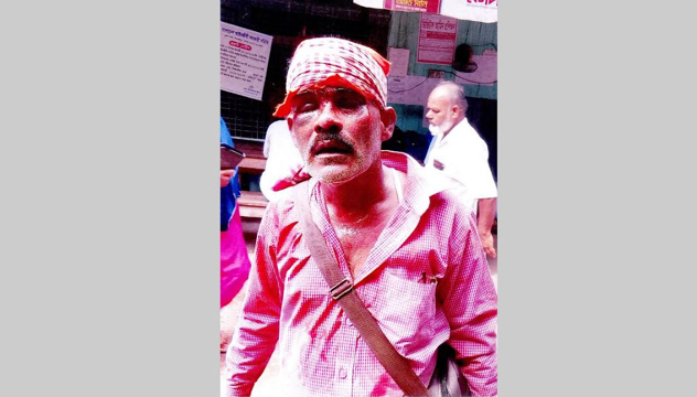 দিনাজপুরে ৪র্থ স্বামীর অন্ডকোষ কামড়ে ছিড়লো স্ত্রী, মামলায় কারাগারে
